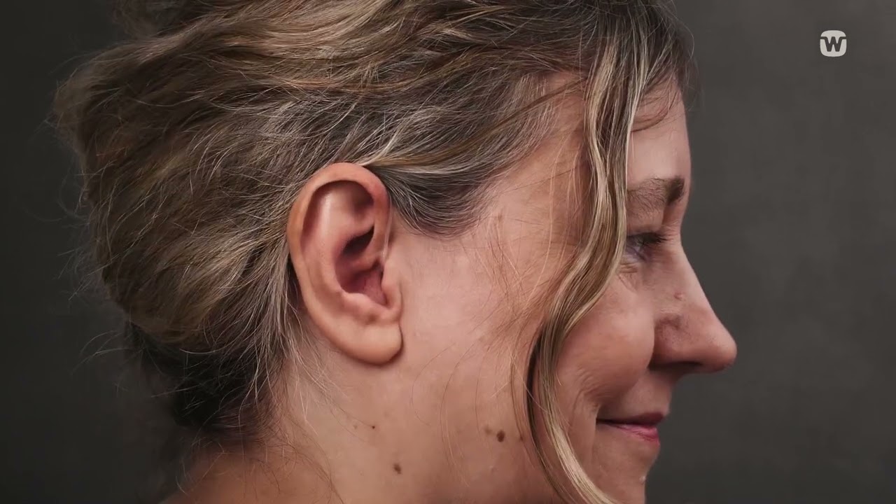 How to insert and remove your Widex Moment BTE with ear tip| Widex hearing aids