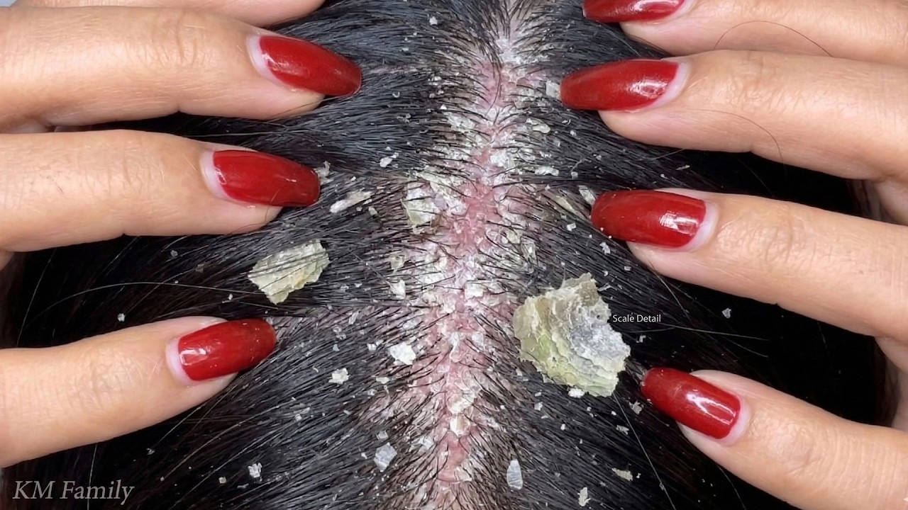 Hair Brushing & Scalp Scratching ASMR #KM0028