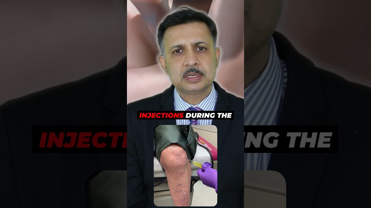 How Painful Is Knee Replacement Surgery? | Best Knee Replacement Surgeon