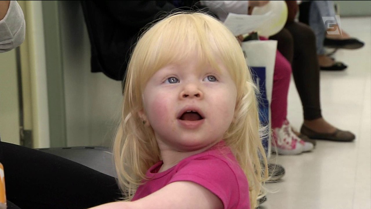 Atendimento médico e psicológico para albinos