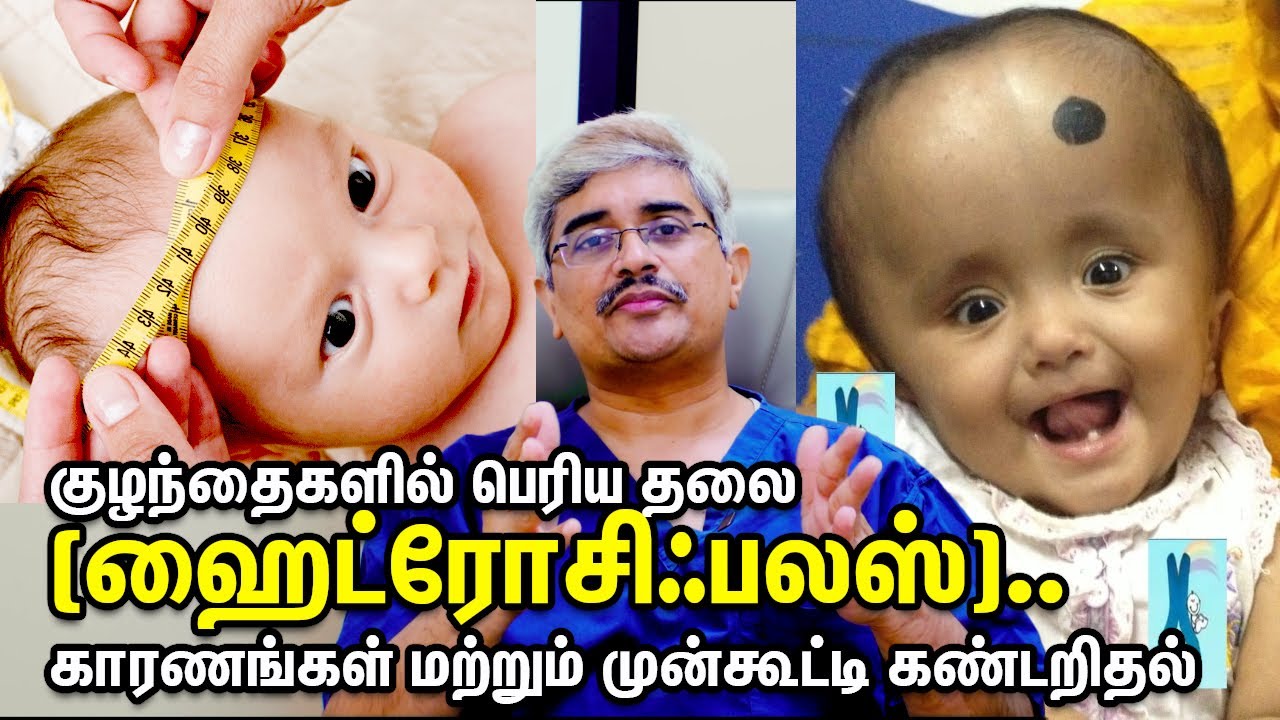 Large head in children ( Hydrocephalus).. causes and early detection Dr.Roopesh Kumar
