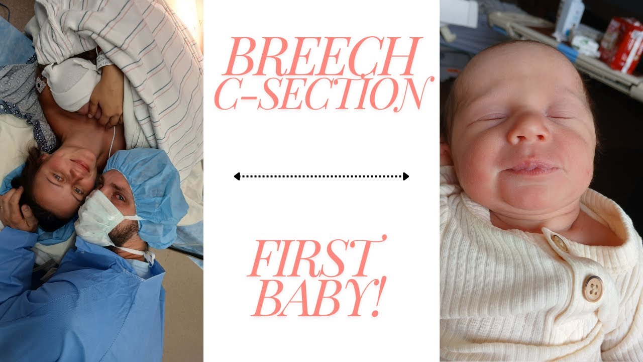 C-SECTION BIRTH STORY - 1ST BABY FRANK BREECH