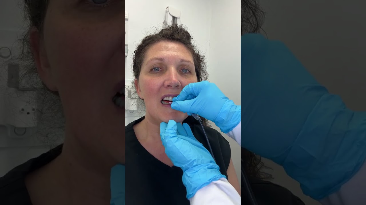 Tip for getting open contacts on bitewings