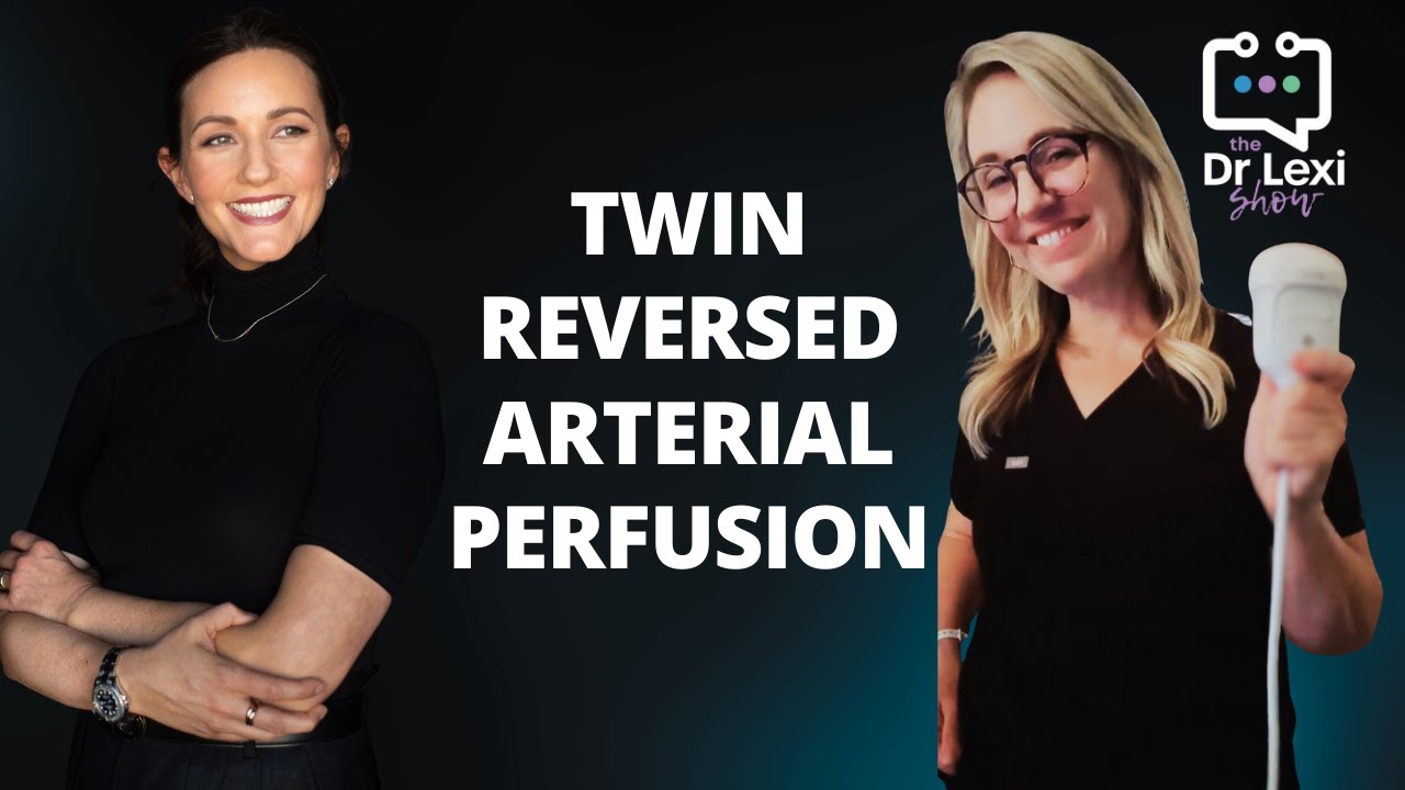 Twin Reversed Arterial Perfusion | High-Risk Doctor and Ultrasonographer Discuss