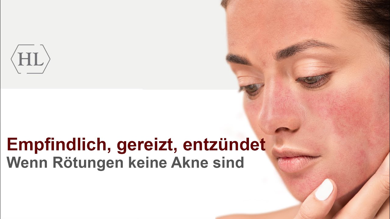 Empfindlich, gereizt, entzündet - Wenn Rötungen keine Akne sind | Webinaraufnahme vom 08.01.2026