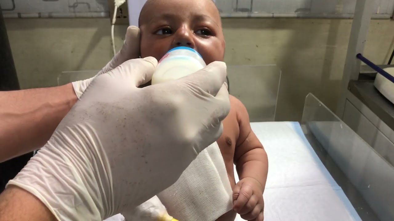 Infant Feeding Protocols in NICU | Gentle Physiotherapy Before Feeding | Step-by-Step Guide