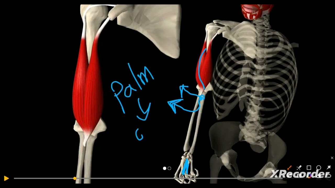 Ms of arm