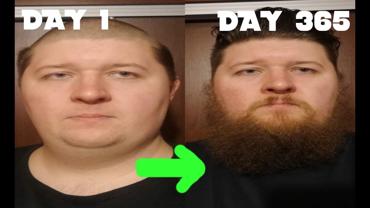 One Year Beard Growth Time-Lapse | #YEARD Challenge