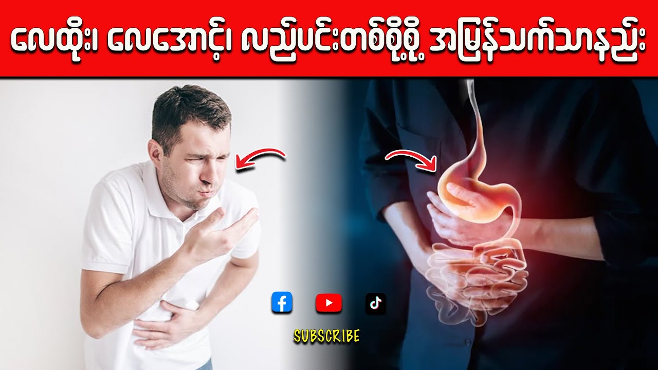 ရင်ပူခြင်း၊ လေပွခြင်း၊ စားချဉ်ပြန်ရောဂါ အမြန်သက်သာစေမယ့်နည်း နဲ့ အစာအိမ်ဆေးသောက်နည်း