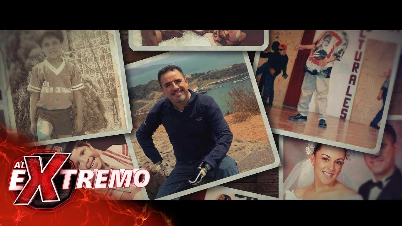 ¡La historia de Aarón Acosta y el cambio extremo que sufrió por un accidente! | Al Extremo