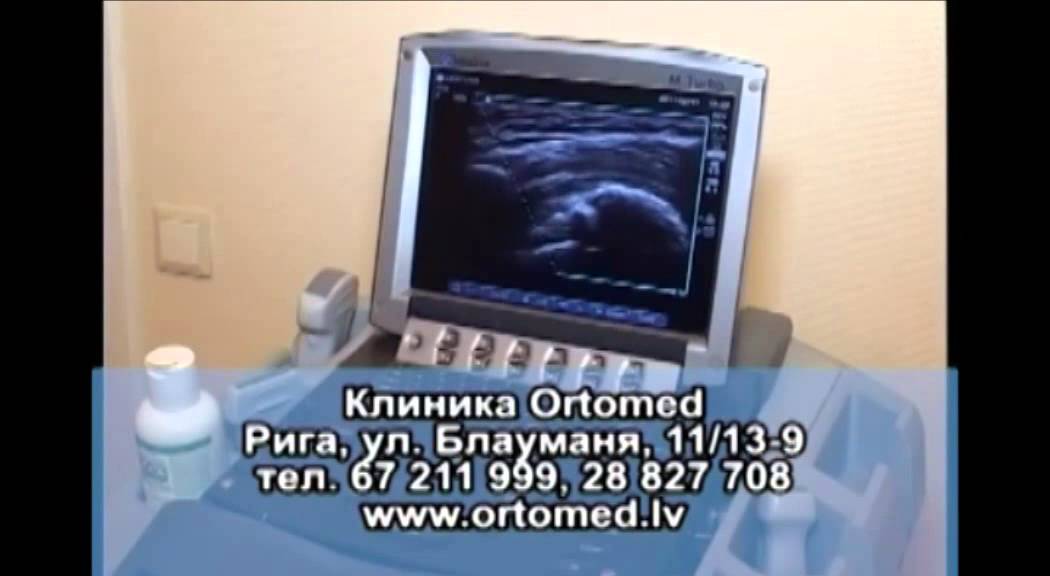 Клиника Ортомед в передаче 