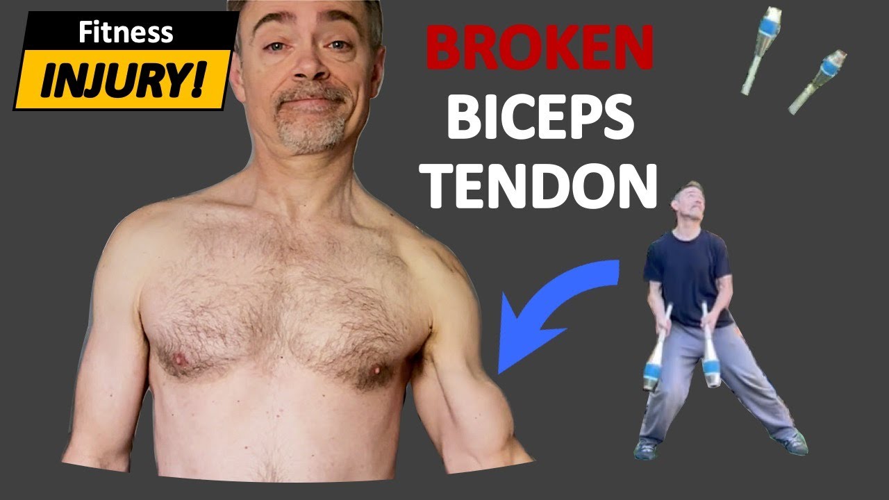 I Snapped A Biceps Tendon - While Juggling!