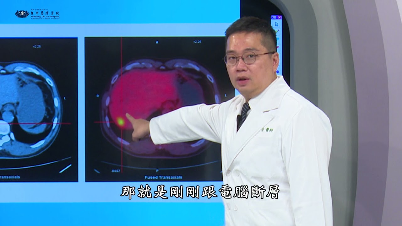 臺中慈濟醫院特色醫療－一般外科＼挑戰型內視鏡切肝手術