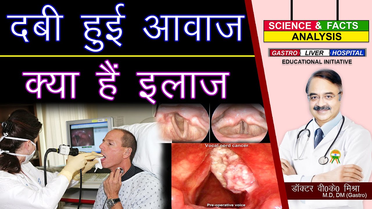 दबी हुई आवाज़ क्या है इलाज ||  LARYNGITIS DIAGNOSIS AND TREATMENT