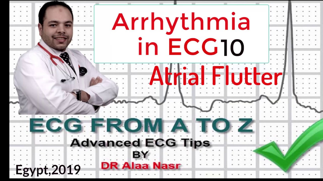 ECG from A to Z, intermediate level, Arrhythmia 10, Dr Alaa Nasr, 2019