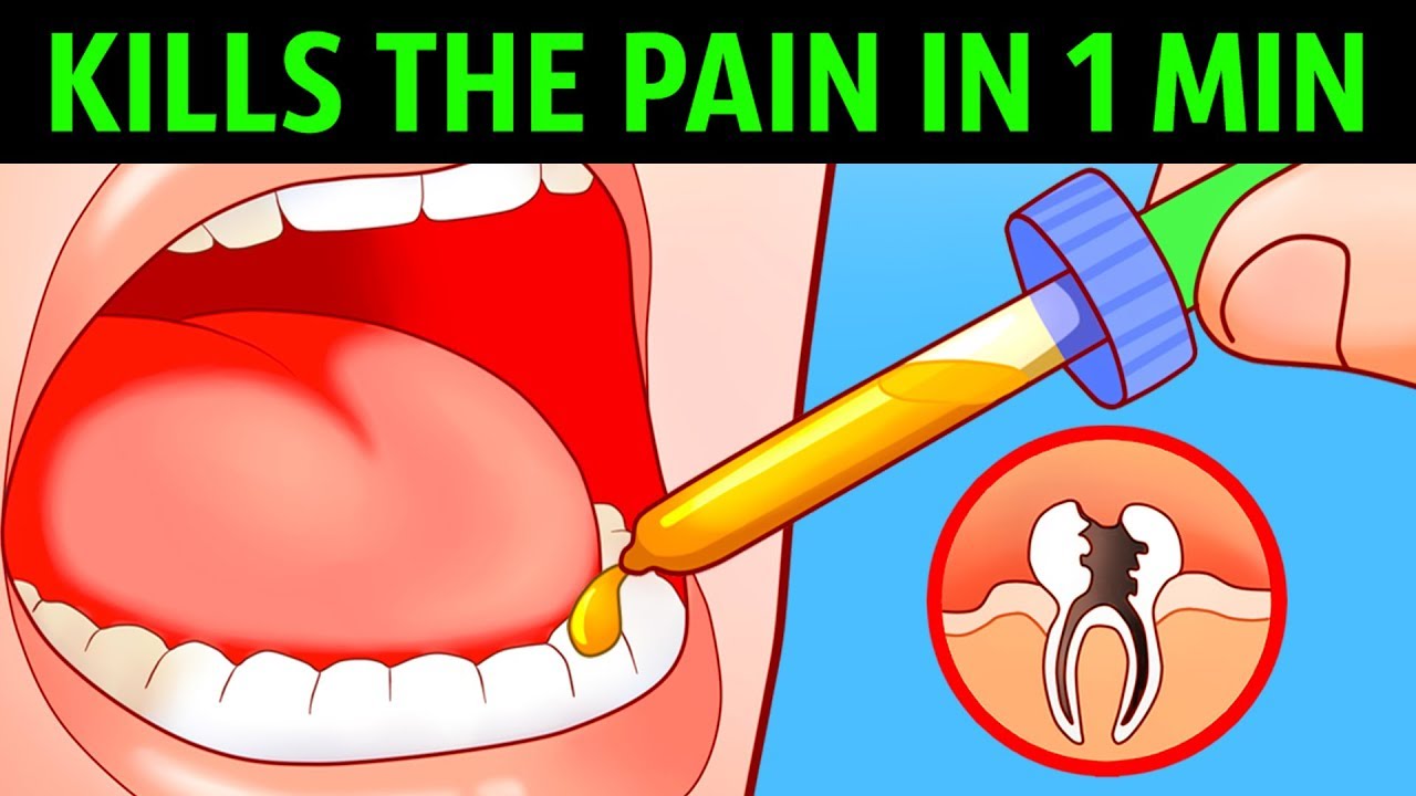 10&nbsp;Ways to&nbsp;Kill a&nbsp;Toothache In a Minute