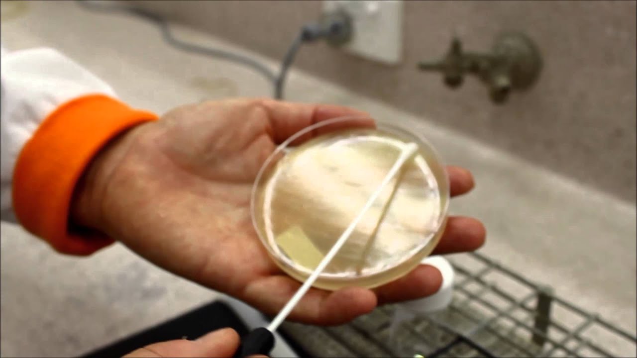 Swabbing a plate