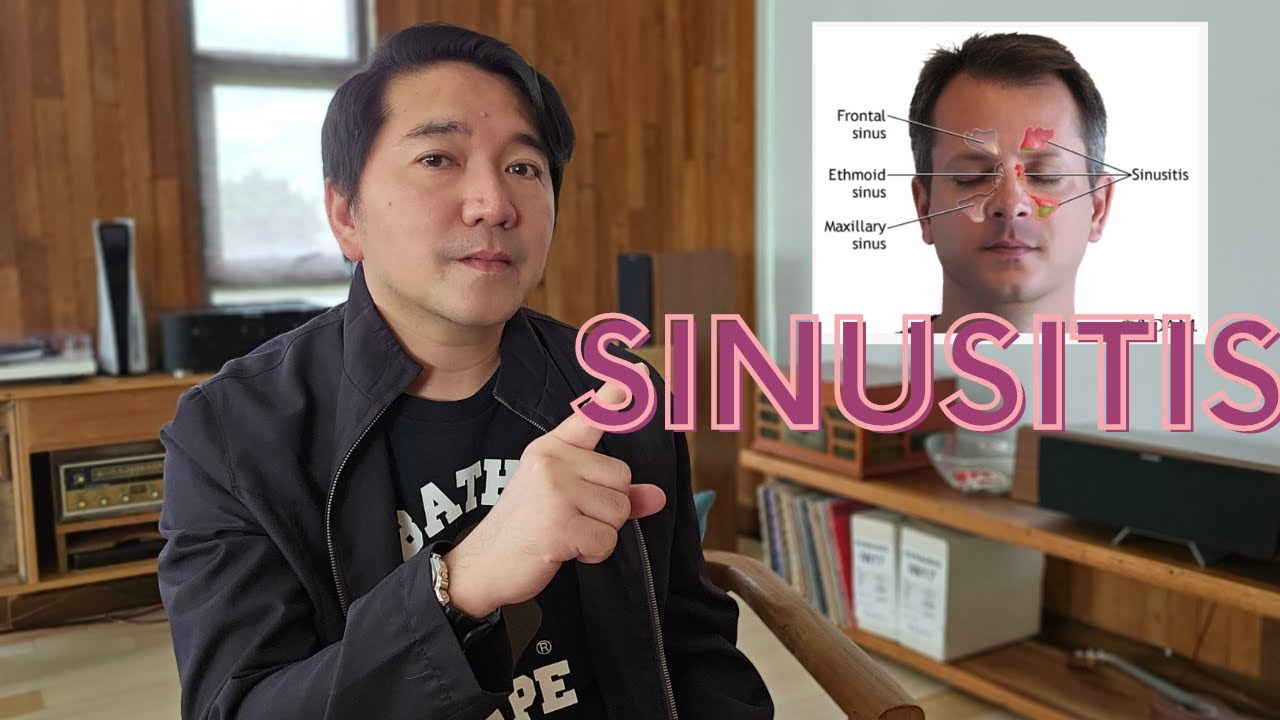 BIKTIMA ka ba ng SINUSITIS?