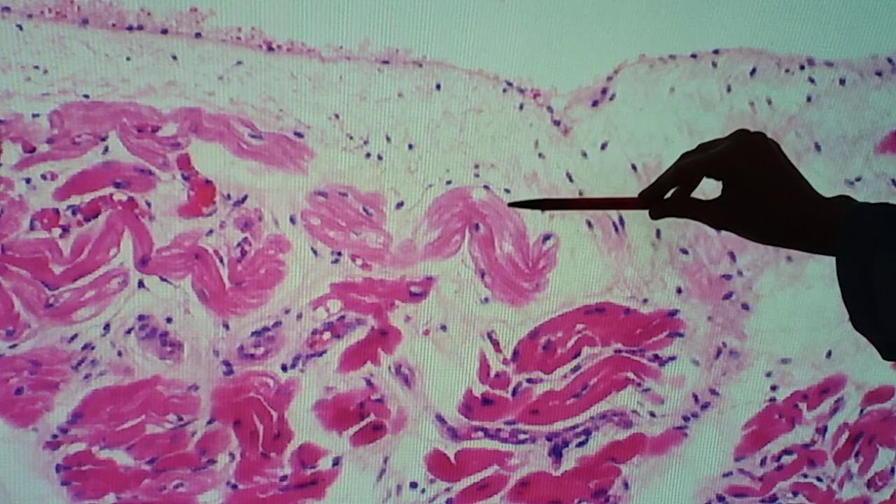 Histologia do coração