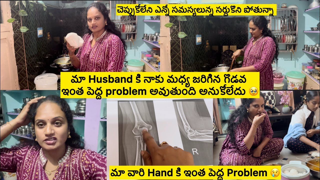 మా మధ్య గొడవ ఇంత పెద్ద సమస్యకి దారి తీసింది🥹/మావారి Hand కి🥹/మనకి నచినట్టే జీవితం ఉండదు సర్దుకోవాలి😢