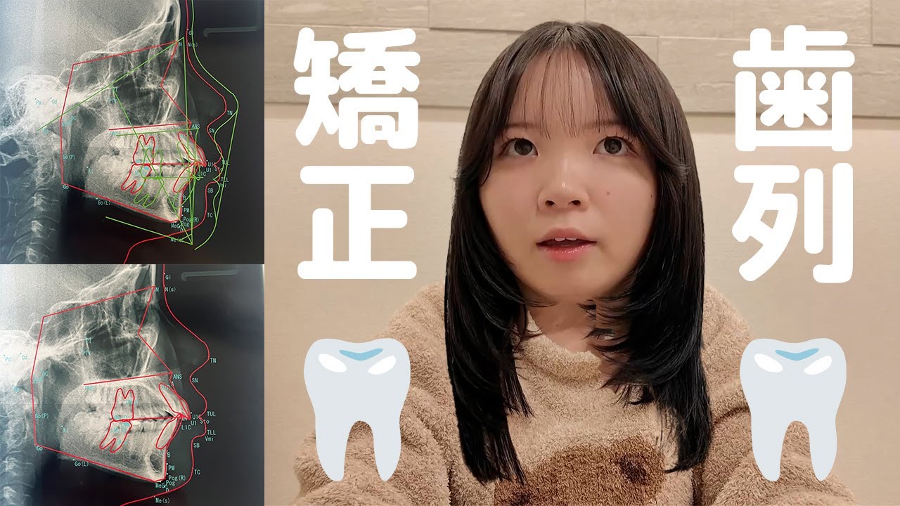 【歯列矯正】借金をする必要がある美容について