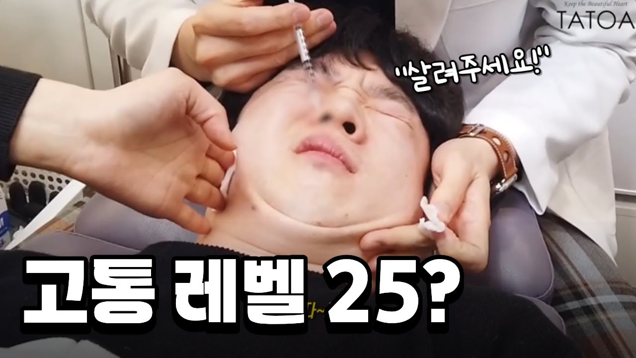 고통은 신이 주신 선물이라더니...콧볼 보톡스 맞고 참교육 받은 자의 리얼 반응 ㅋㅋㅋ