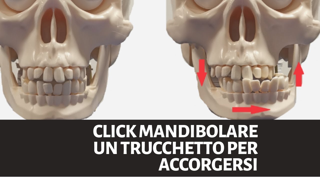 Click Mandibolare   UN TRUCCHETTO UTILE