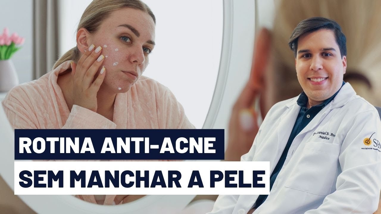 ROTINA ANTI-ACNE SEM MANCHAR A PELE