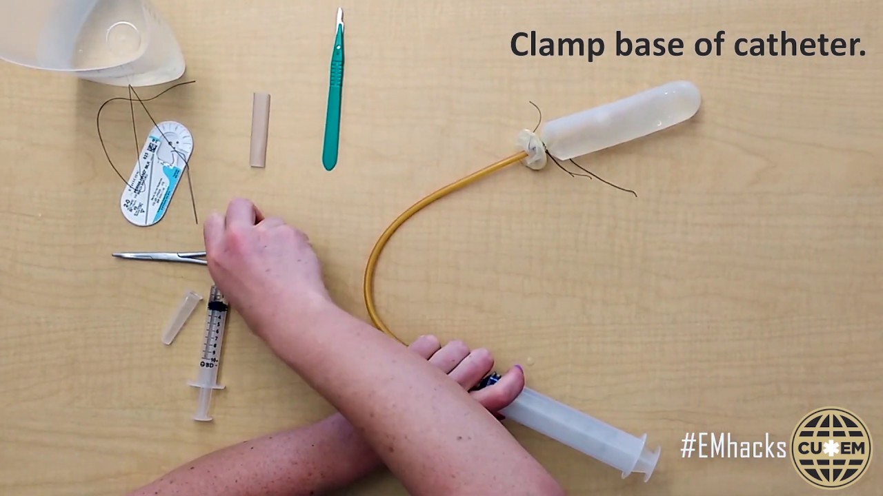How to Make a Modified Bakri Balloon for Uterine Tamponade