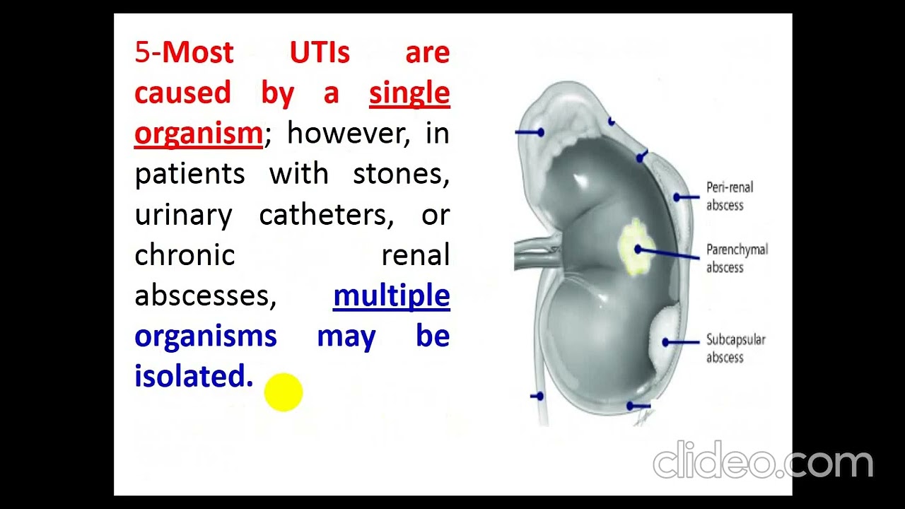 UTI 2024 By Dr  Dheyaa Jabbar