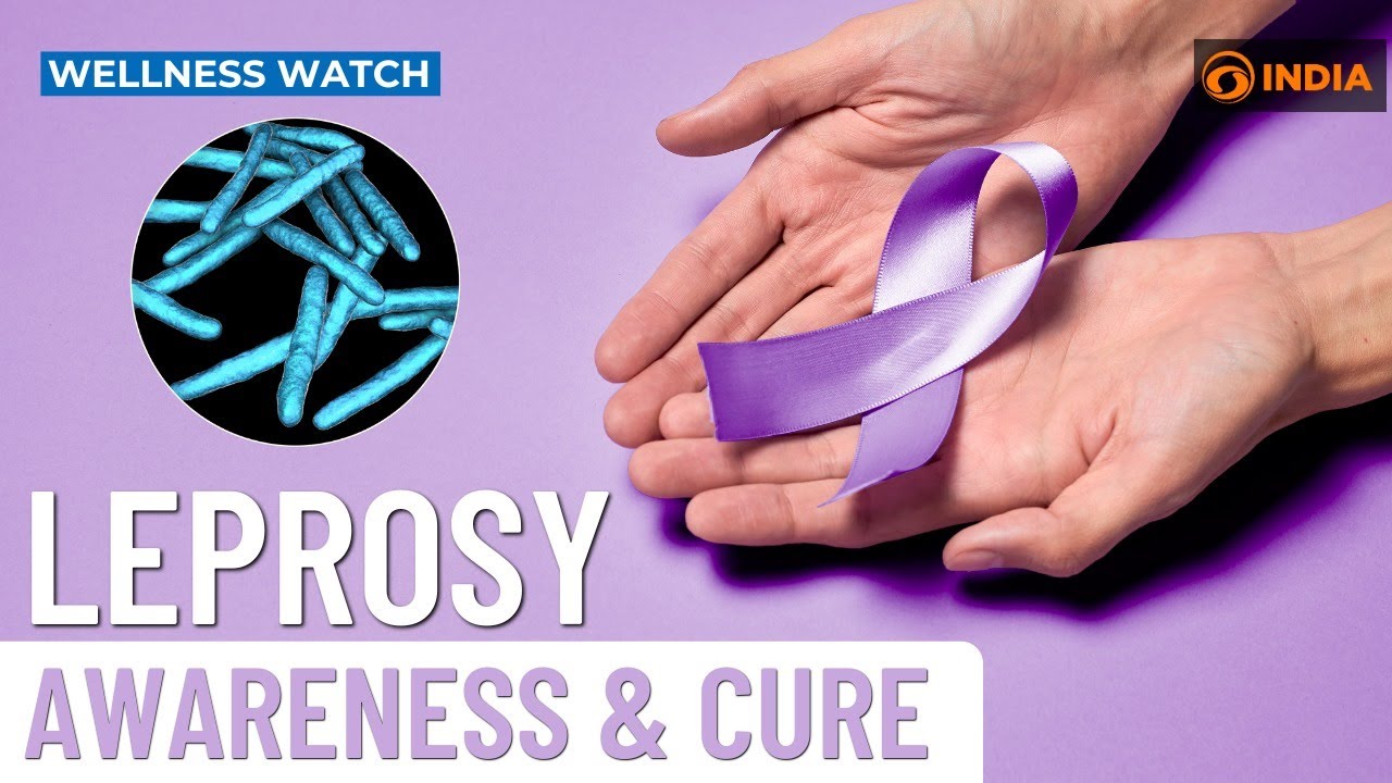 Leprosy: Awareness & Cure | Wellness Watch