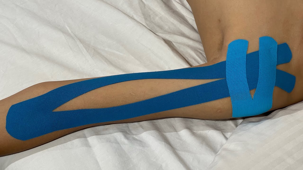 Kinesiotaping para tendinitis del bíceps braquial