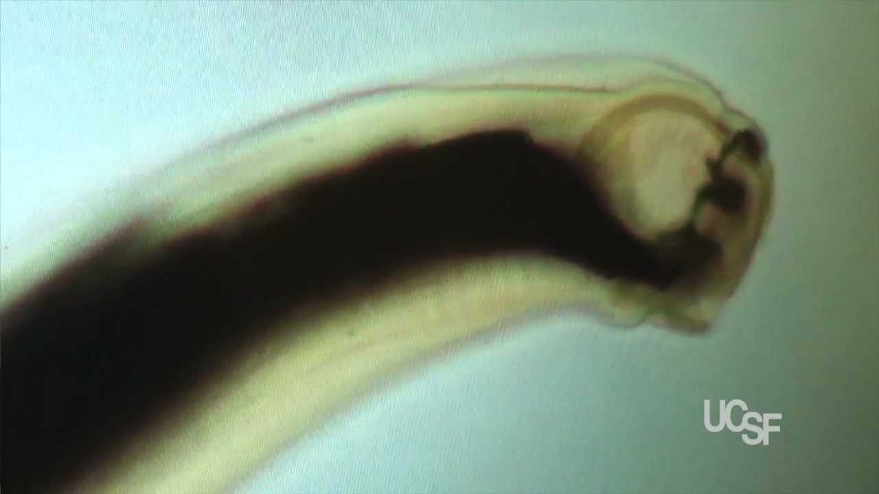 New Drug Prospect Offers Hope against Hookworm Infections