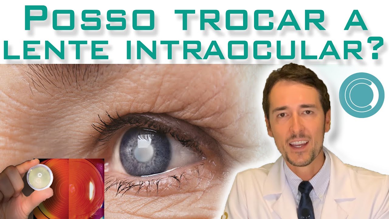 É possível trocar a lente intraocular após a cirurgia de catarata?