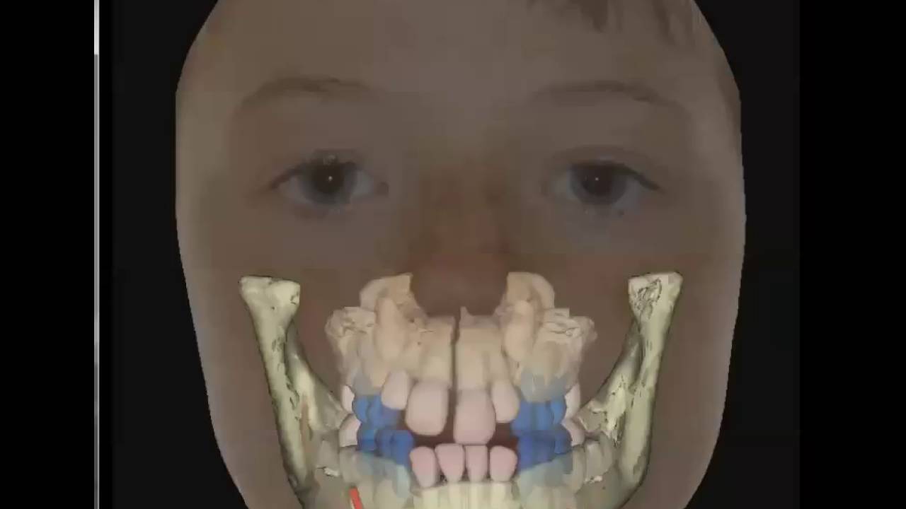 3D digital diagnosis and treatment planning