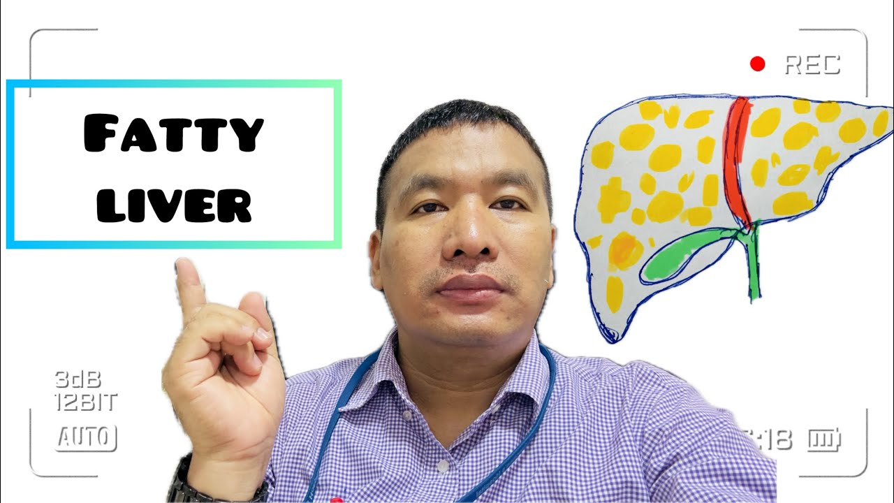 Fatty Liver: The Silent Killer - Symptoms, Causes & How to Reverse It Fast ( Explained in Nagamese).