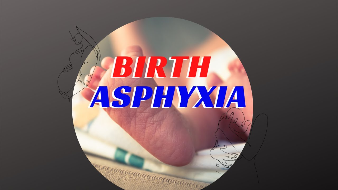 Birth Asphyxia - Birth injury lawsuit | Can lack of oxygen at birth cause brain damage #birthinjury