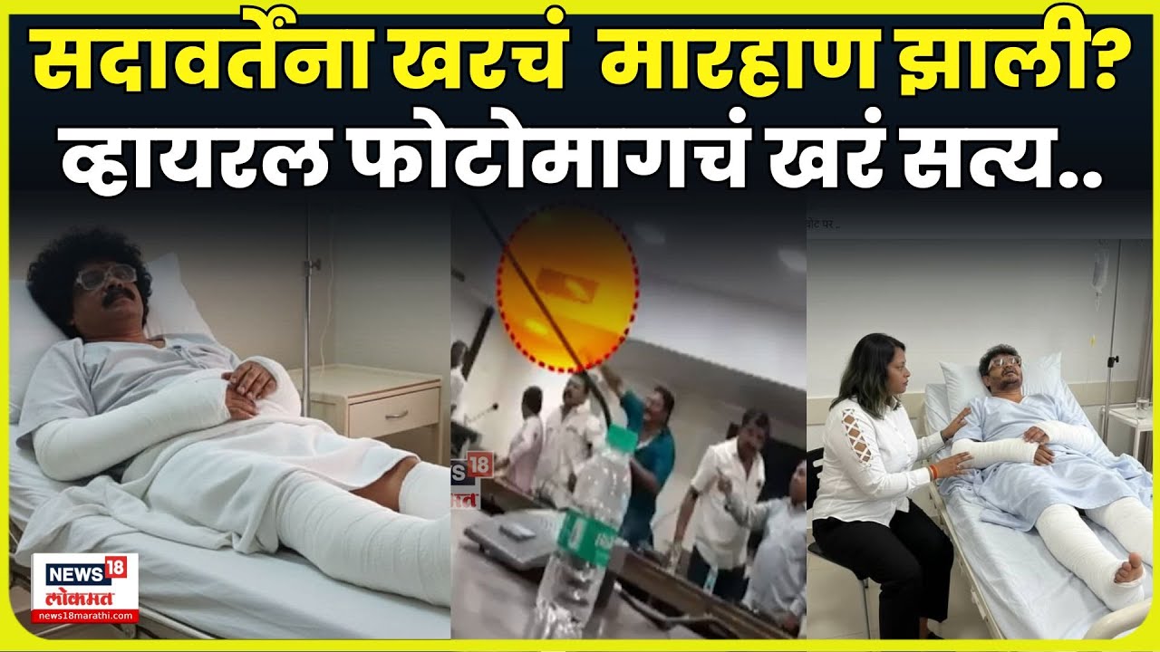 Gunratna Sadavarte Viral Photo Fact Check | गुणरत्न सदावर्तेंना खरचं मारहाण झाली? सत्य काय? N18V