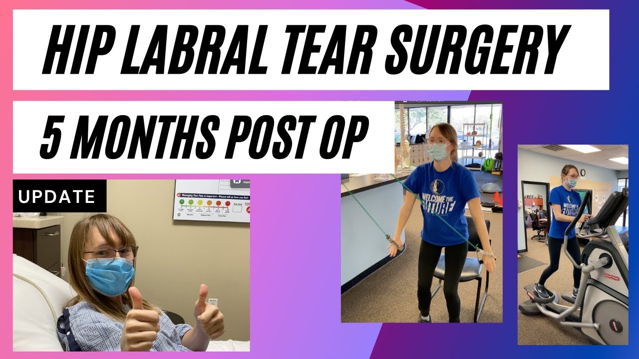 Hip Preservation Surgery | Labral Tear & FAI | 5 Months Post Op
