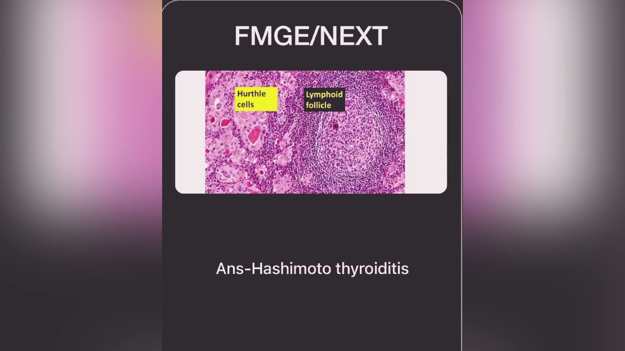5 FLASHCARD REVISION/FMGE/NEXT/ LEARN_REVISE_MUSTKNOW