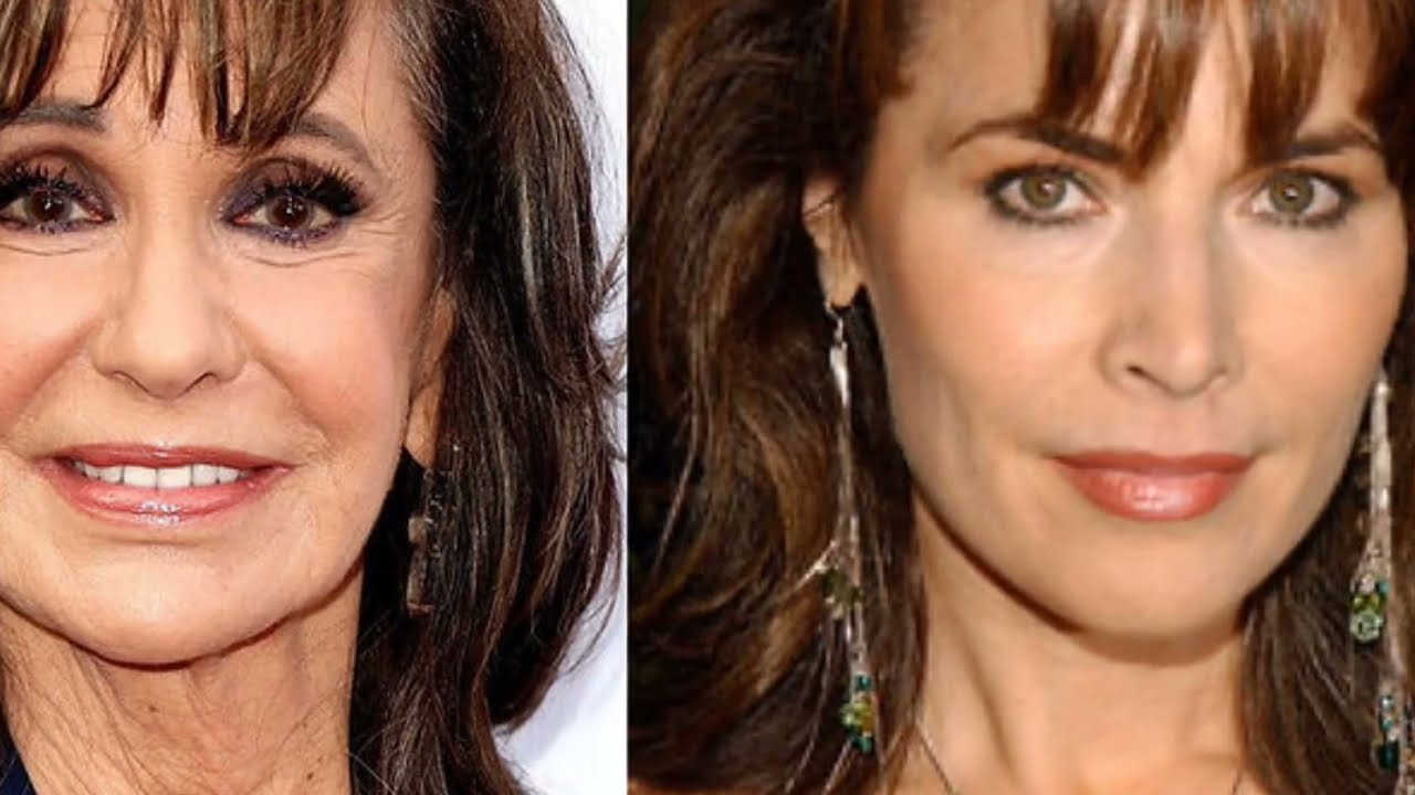 DAYS Fans PANIC as Lauren Koslow Joins Y&R &mdash; Here&rsquo;s the REAL Story!