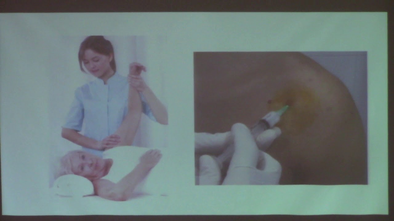 tenodesis biceps dr paucar