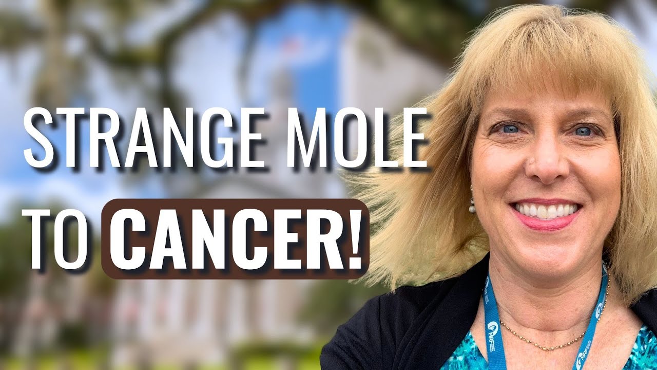 This Spot On My Skin Turned Out To Be CANCER! - Kristin | Melanoma | The Patient Story