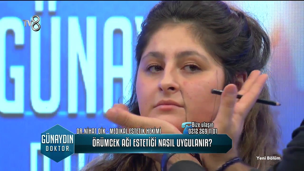 Ameliyatsız Yüz Germe - Örümcek Ağı Estetiği
