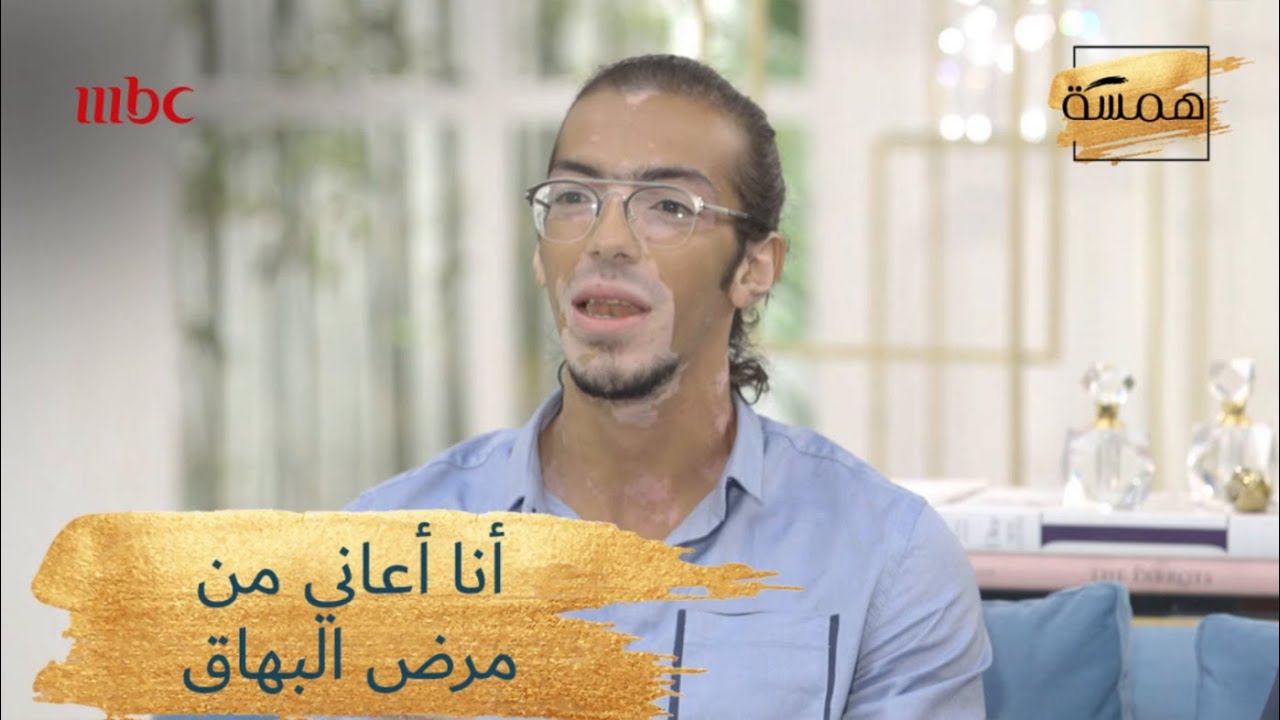 عارض الأزياء محمود يتحدث عن تجربته مع مرض البهاق!