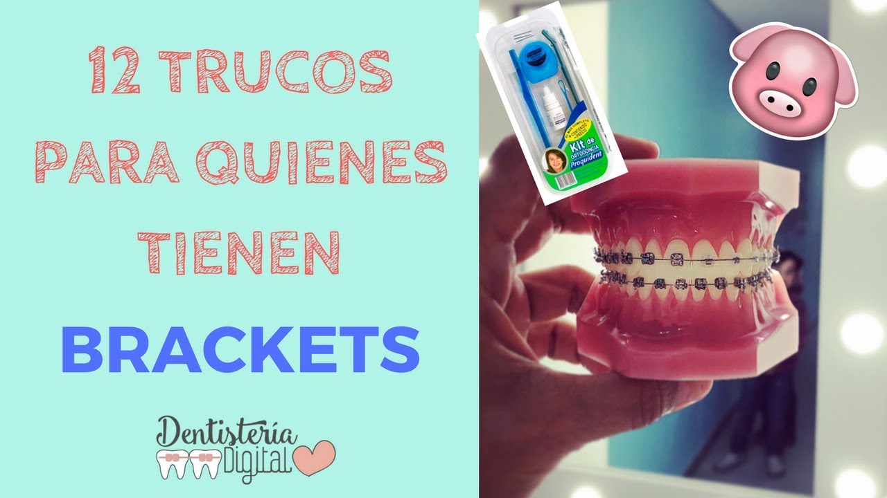 12 Trucos / Hacks para quienes tienen brackets - Contado por una Ortodoncista