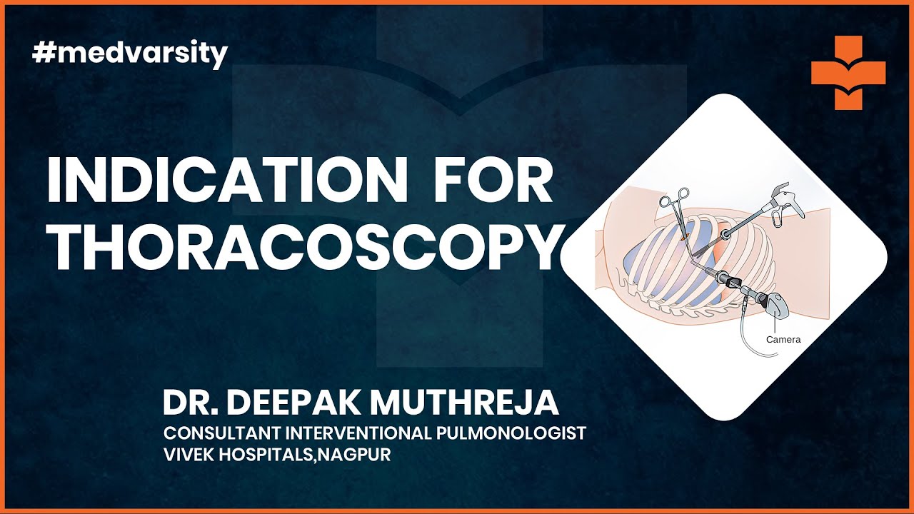 Indication for Thoracoscopy | Medvarsity