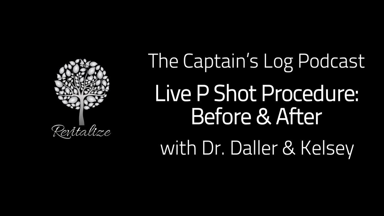 Live P Shot Procedure - Before & After