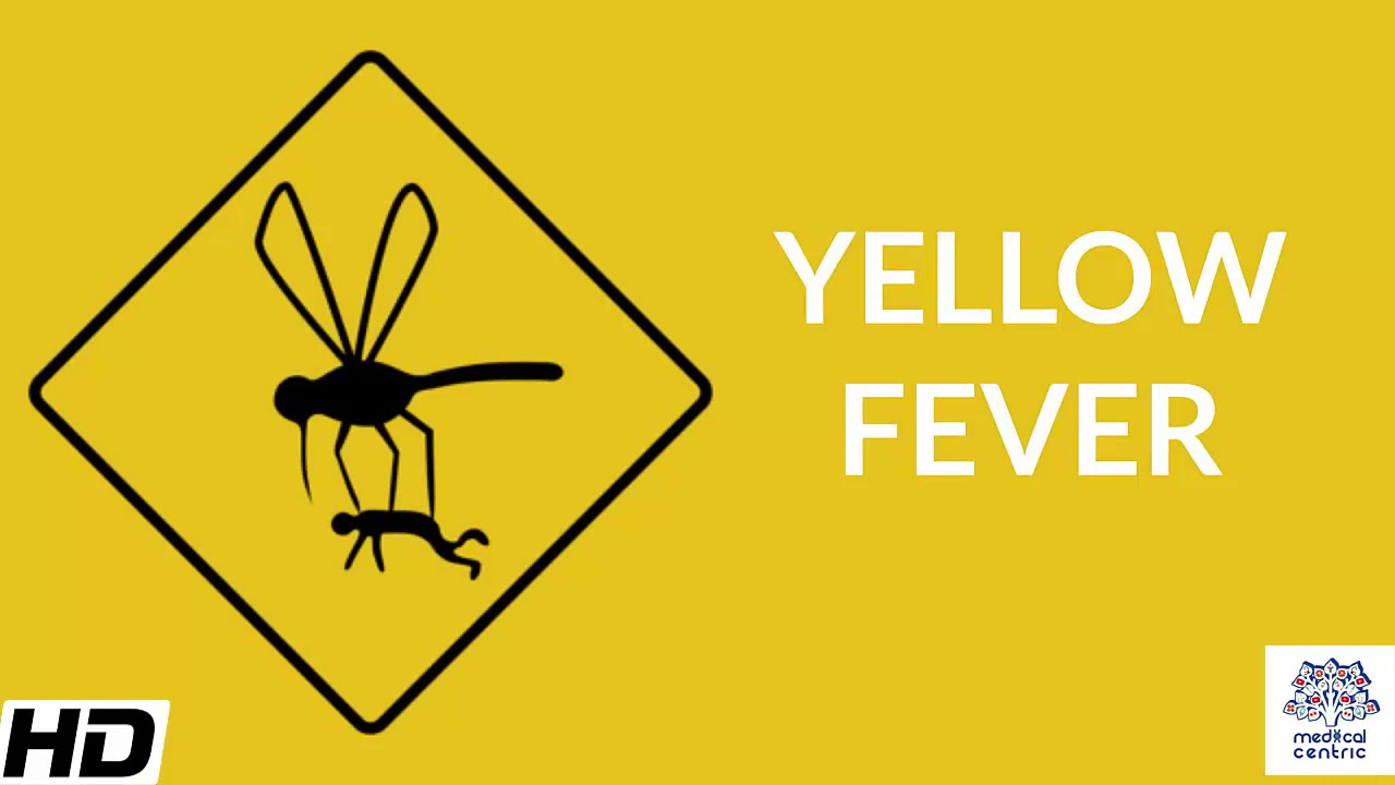 Yellow Fever, Causes, Signs and Symptoms, Diagnosis and Treatment.