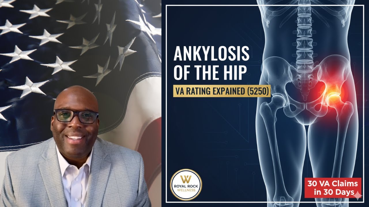 VA Rating for Ankylosis of the Hip Explained (Diagnostic Code 5250)